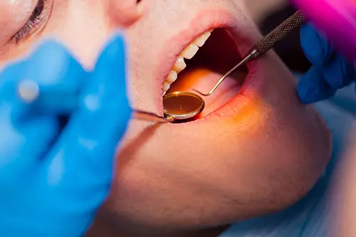 2025-06-30-gum-disease-and-braces